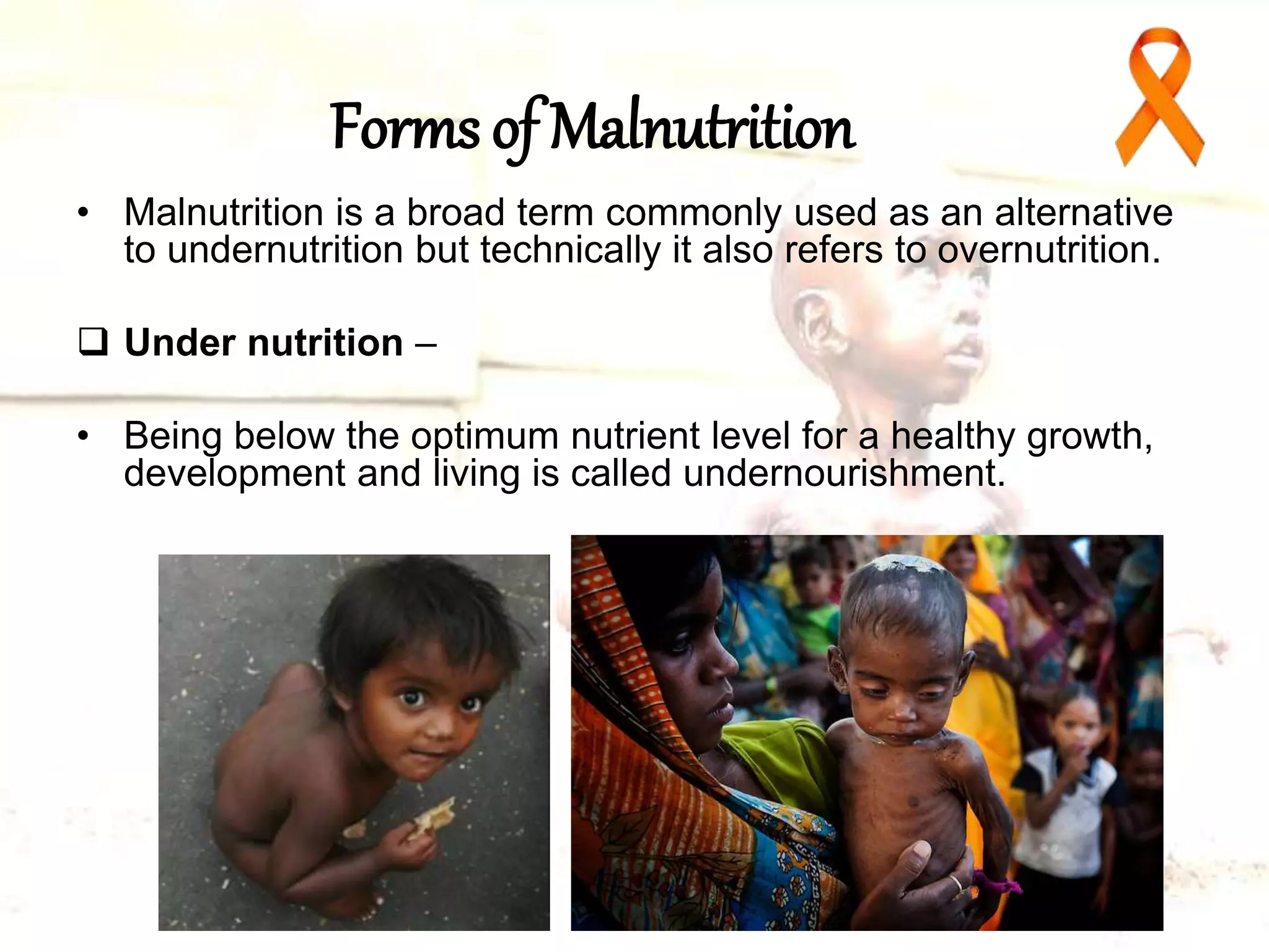 Malnutrition in Indian children | PPTX