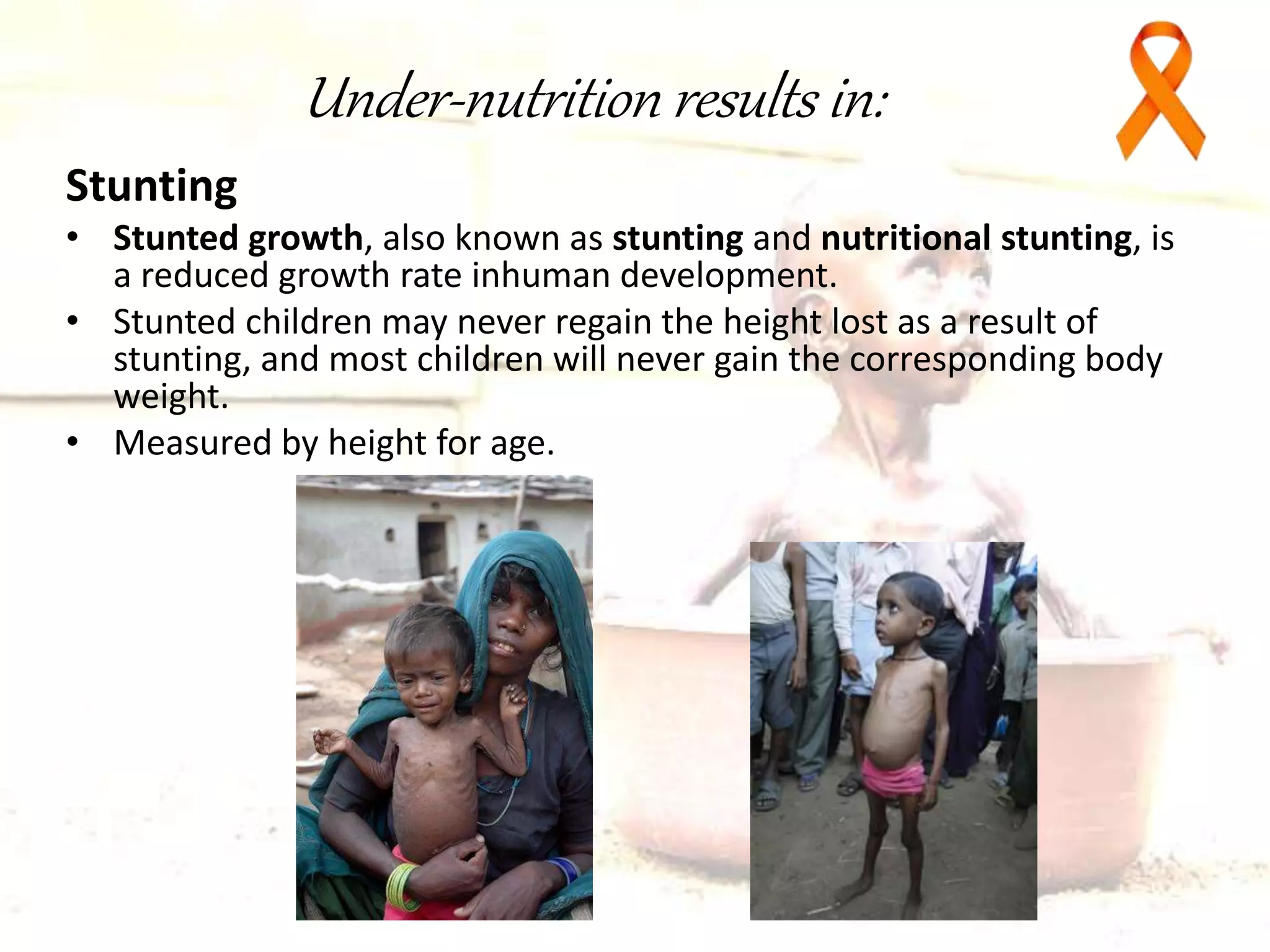 Malnutrition in Indian children | PPTX