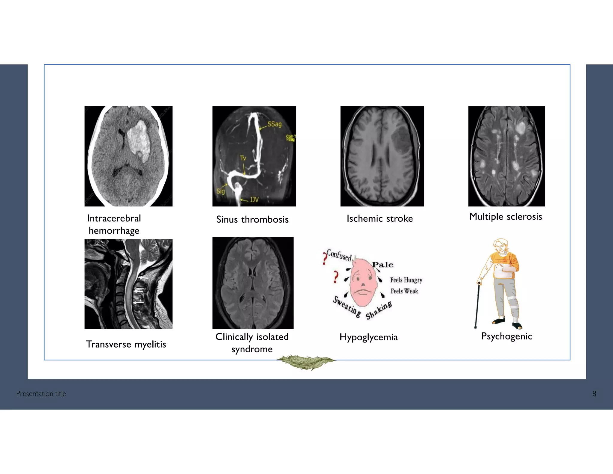 Intracerebral
hemorrhage
Transverse myelitis
Sinus thrombosis
Clinically isolated
syndrome
Hypoglycemia
Multiple sclerosis
Psychogenic
Presentation title 8
Ischemic stroke
 