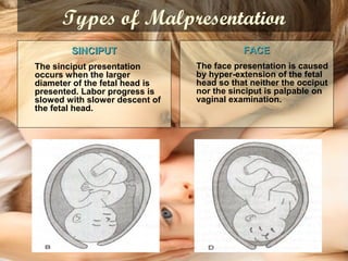 Types of Malpresentation
SINCIPUTSINCIPUT
The sinciput presentation
occurs when the larger
diameter of the fetal head is
presented. Labor progress is
slowed with slower descent of
the fetal head.
FACEFACE
The face presentation is caused
by hyper-extension of the fetal
head so that neither the occiput
nor the sinciput is palpable on
vaginal examination.
 