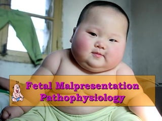 Fetal MalpresentationFetal Malpresentation
PathophysiologyPathophysiology
 