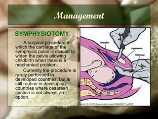 Management
SYMPHYSIOTOMY
A surgical procedure in
which the cartilage of the
symphysis pubis is divided to
widen the pelvis allowing
childbirth when there is a
mechanical problem.
Currently the procedure is
rarely performed in
developed countries, but is
still routine in developing
countries where cesarean
section is not always an
option.
 