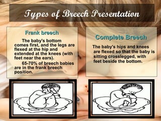 Types of Breech Presentation
Frank breechFrank breech
The baby's bottom
comes first, and the legs are
flexed at the hip and
extended at the knees (with
feet near the ears).
65-70% of breech babies
are in the frank breech
position.
Complete BreechComplete Breech
The baby's hips and knees
are flexed so that the baby is
sitting crosslegged, with
feet beside the bottom.
 