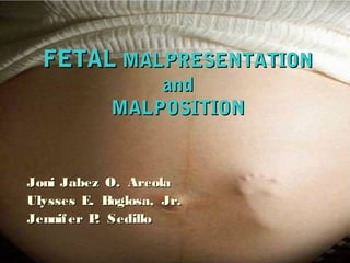 FETALFETAL MALPRESENTATIONMALPRESENTATION
andand
MALPOSITIONMALPOSITION
Joni Jabez O. AreolaJoni Jabez O. Areola
Ulysses E. Boglosa, Jr.Ulysses E. Boglosa, Jr.
Jennifer P. SedilloJennifer P. Sedillo
 