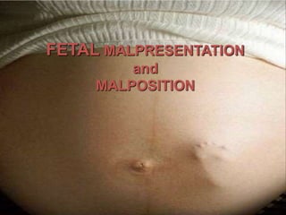 FETAL MALPRESENTATION
and
MALPOSITION
 