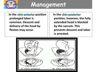Management
In the chin-anterior position
prolonged labor is
common. Descent and
delivery of the head by
flexion may occur.
In the chin-posterior
position, however, the fully
extended head is blocked
by the sacrum. This
prevents descent and labor
is arrested.
 