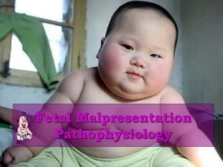 Fetal Malpresentation
Pathophysiology
 