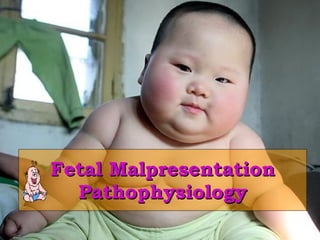 Fetal Malpresentation Pathophysiology 