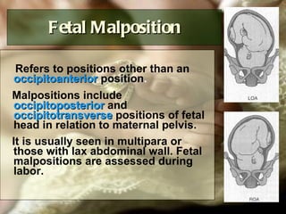 Fetal Malposition Refers to positions other than an  occipitoanterior  position .  Malpositions include  occipitoposterior  and  occipitotransverse  positions of fetal head in relation to maternal pelvis.  It is usually seen in multipara or those with lax abdominal wall. Fetal malpositions are assessed during labor.   