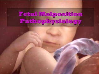 Fetal Malposition Pathophysiology 
