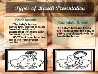 Types of Breech Presentation Frank breech   The baby's bottom comes first, and the legs are flexed at the hip and extended at the knees (with feet near the ears).  65-70% of breech babies are in the frank breech position. Complete Breech   The baby's hips and knees are flexed so that the baby is sitting crosslegged, with feet beside the bottom.  