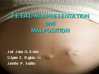 FETAL  MALPRESENTATION and MALPOSITION Joni Jabez O. Areola Ulysses E. Boglosa, Jr. Jennifer P. Sedillo 