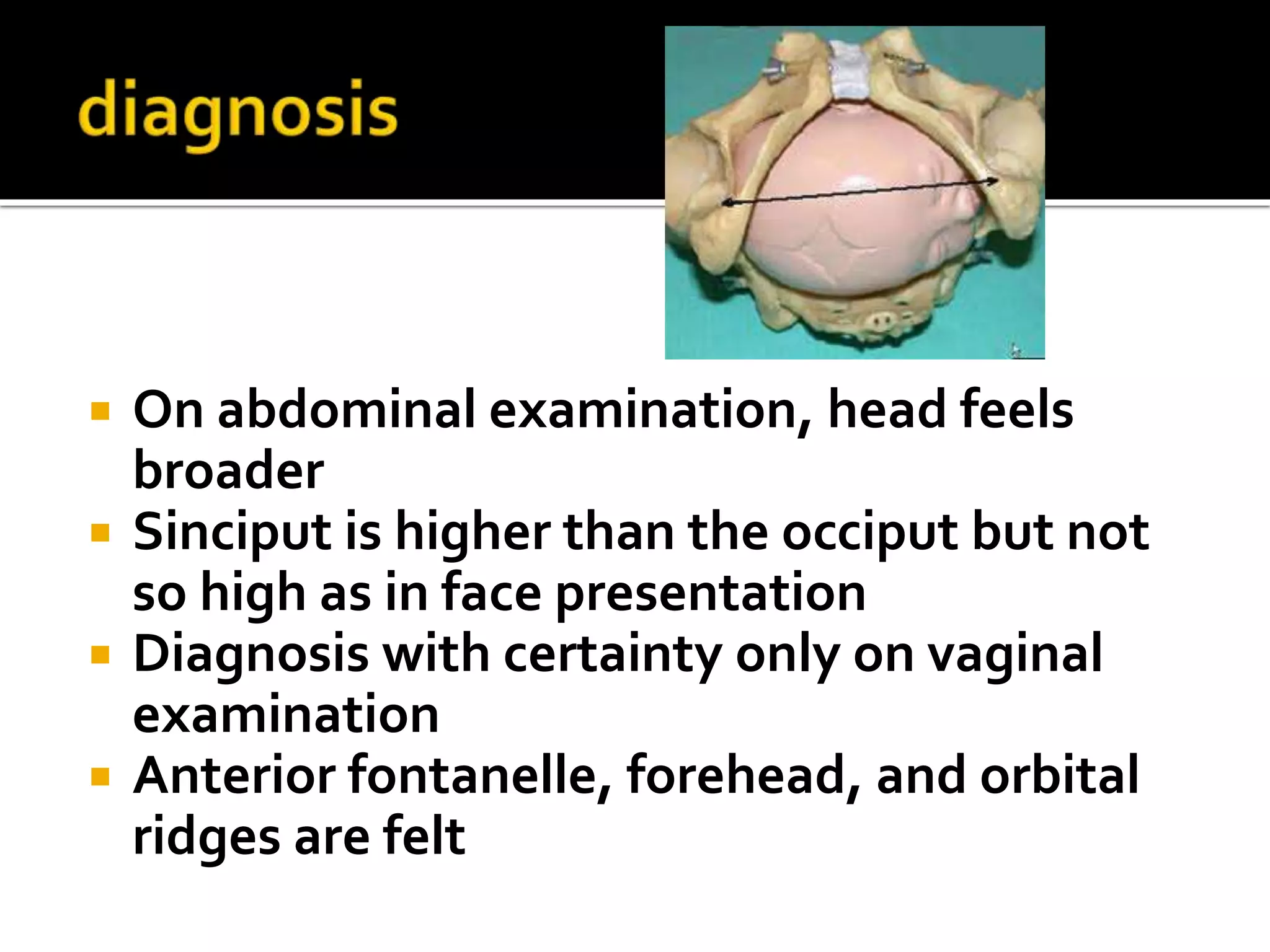  On abdominal examination, head feels
broader
 Sinciput is higher than the occiput but not
so high as in face presentation
 Diagnosis with certainty only on vaginal
examination
 Anterior fontanelle, forehead, and orbital
ridges are felt
 