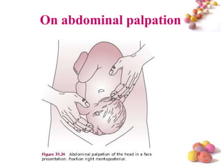 On abdominal palpation

#

 