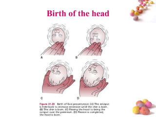 Birth of the head

#

 