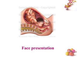 Face presentation
#

 