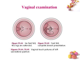 Vaginal examination

#

 