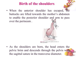 Birth of the shoulders
• When the anterior shoulder has escaped, the
buttocks are lifted towards the mother’s abdomen
to enable the posterior shoulder and arm to pass
over the perineum .

• As the shoulders are born, the head enters the
pelvic brim and descends through the pelvis with
#
the sagittal suture in the transverse diameter.

 