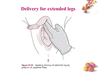 Delivery for extended legs

#

 