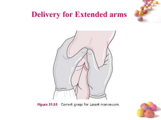 Delivery for Extended arms

#

 