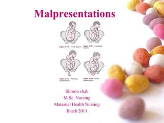 Malpresentations

Shrooti shah
M.Sc. Nursing
Maternal Health Nursing
Batch 2011

 