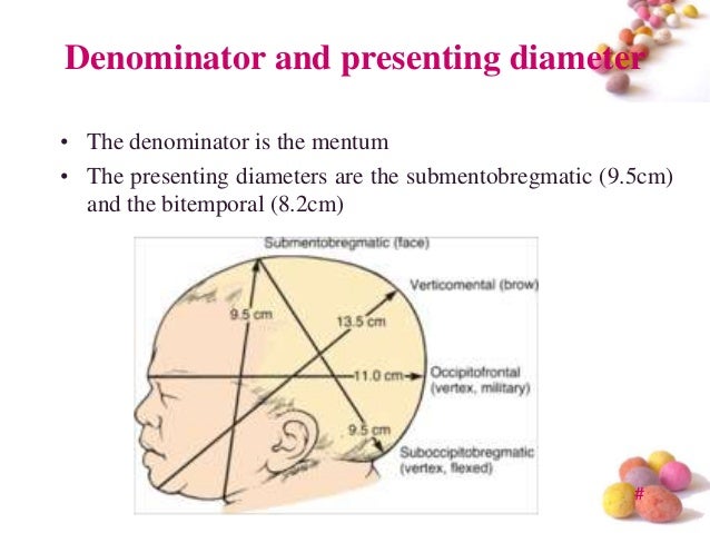 brow presentation presenting diameter