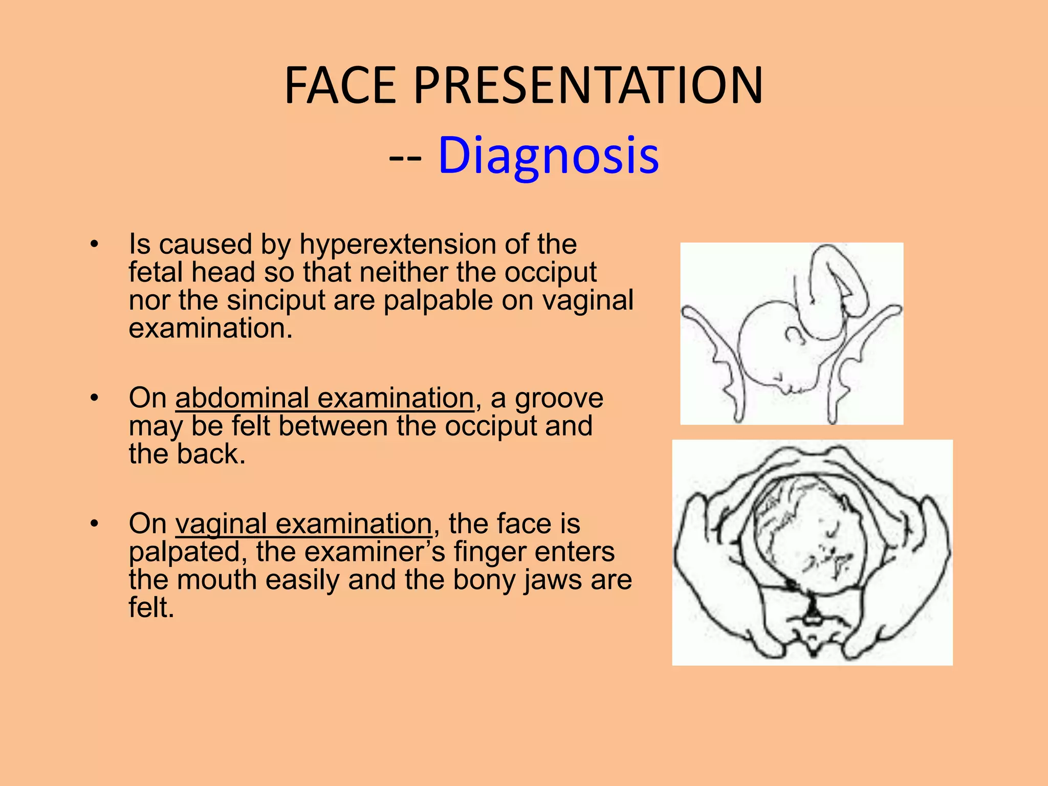FACE PRESENTATION
                  -- Diagnosis
• Is caused by hyperextension of the
  fetal head so that neither the occiput
  nor the sinciput are palpable on vaginal
  examination.

• On abdominal examination, a groove
  may be felt between the occiput and
  the back.

• On vaginal examination, the face is
  palpated, the examiner’s finger enters
  the mouth easily and the bony jaws are
  felt.
 