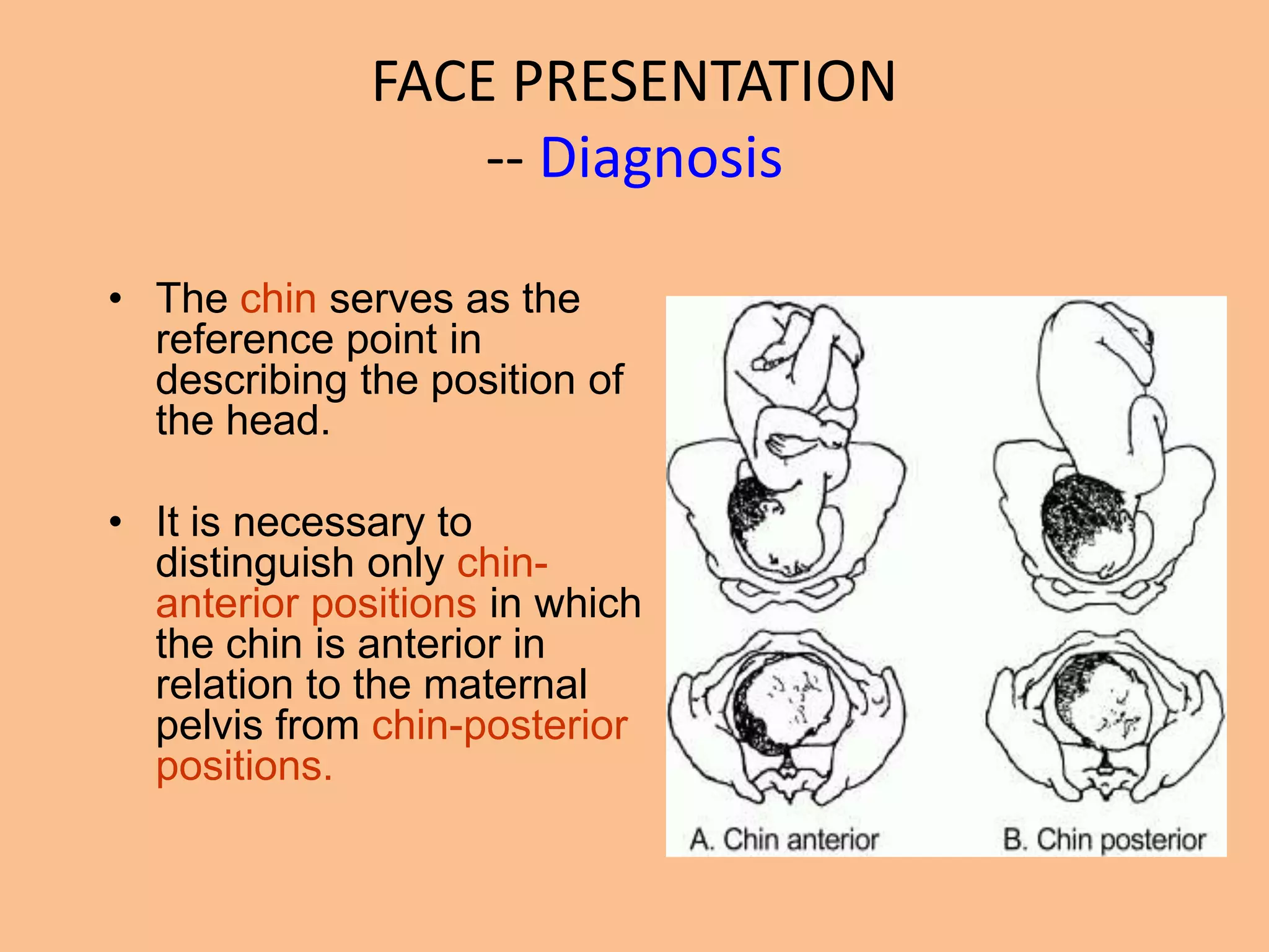 FACE PRESENTATION
                  -- Diagnosis

• The chin serves as the
  reference point in
  describing the position of
  the head.

• It is necessary to
  distinguish only chin-
  anterior positions in which
  the chin is anterior in
  relation to the maternal
  pelvis from chin-posterior
  positions.
 
