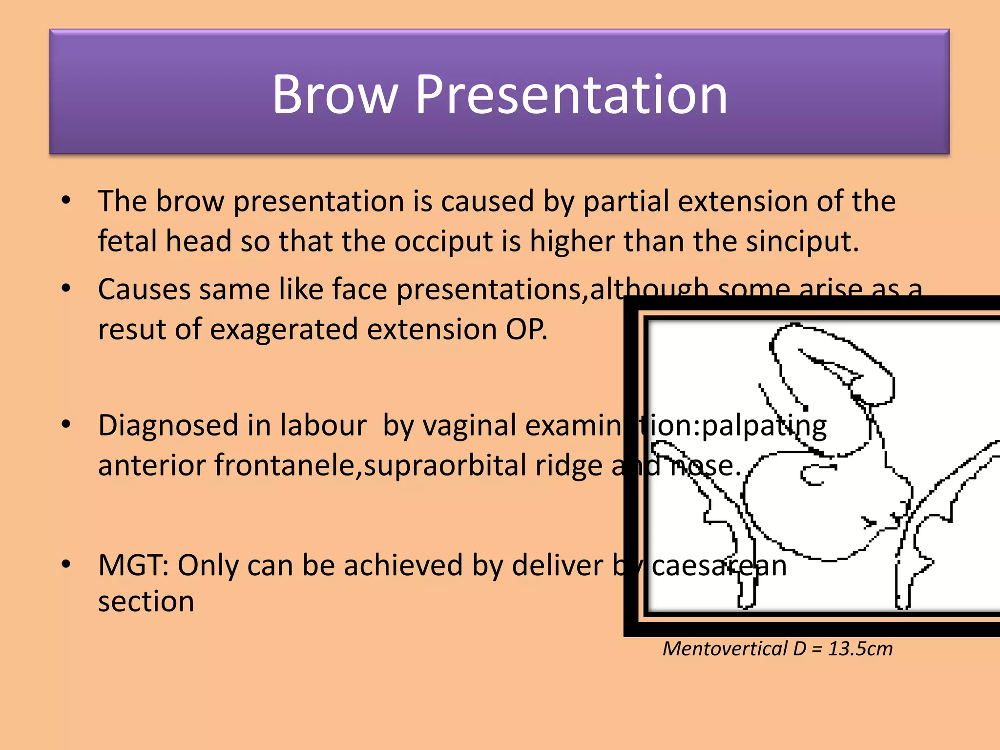 Brow Presentation
• The brow presentation is caused by partial extension of the
  fetal head so that the occiput is higher than the sinciput.
• Causes same like face presentations,although some arise as a
  resut of exagerated extension OP.

• Diagnosed in labour by vaginal examination:palpating
  anterior frontanele,supraorbital ridge and nose.


• MGT: Only can be achieved by deliver by caesarean
  section
                                           Mentovertical D = 13.5cm
 