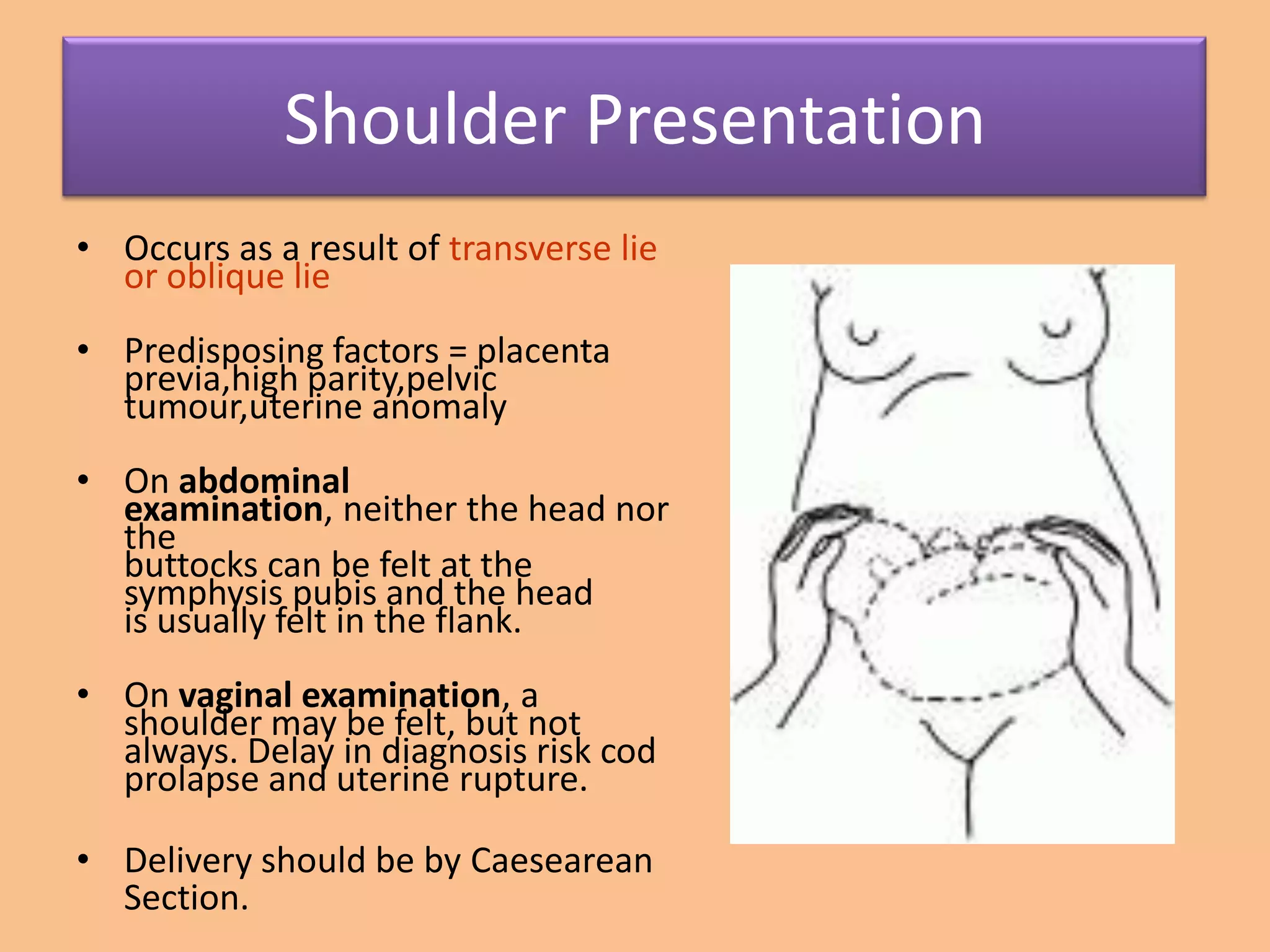 Shoulder Presentation
• Occurs as a result of transverse lie
  or oblique lie
• Predisposing factors = placenta
  previa,high parity,pelvic
  tumour,uterine anomaly
• On abdominal
  examination, neither the head nor
  the
  buttocks can be felt at the
  symphysis pubis and the head
  is usually felt in the flank.
• On vaginal examination, a
  shoulder may be felt, but not
  always. Delay in diagnosis risk cod
  prolapse and uterine rupture.

• Delivery should be by Caesearean
  Section.
 