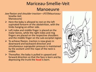 Mariceau-Smellie-Veit
                        Manoeuvre
Jaw flexion and shoulder traction—JFST(Mauriceau-
   Smellie-Veit
   Manoeuvre)
 Here the baby is allowed to rest on the left
   supinated forearm of the obstetrition, with the
   limbs hanging on either side.
 Left index and middle finger is placed on the
   malar bones, while the right index and ring
   fingers are placed on the respective shoulders
   and the middle finger on the sub-occipital region.
 To achieve flexion, traction is now given in
   downward and backward direction and
   simultaneous suprapubic pressure is maintained
   by the assitant until the nape of the neck is
   visible.
 Thereafter, the baby is pulled in upward and
   forward direction so that the face is born and by
   depressing the trunk the head is born.
 