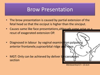 Brow Presentation
• The brow presentation is caused by partial extension of the
  fetal head so that the occiput is higher than the sinciput.
• Causes same like face presentations,although some arise as a
  resut of exagerated extension OP.

• Diagnosed in labour by vaginal examination:palpating
  anterior frontanele,supraorbital ridge and nose.


• MGT: Only can be achieved by deliver by caesarean
  section
                                           Mentovertical D = 13.5cm
 