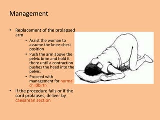 Management

• Replacement of the prolapsed
  arm
        • Assist the woman to
          assume the knee-chest
          position
        • Push the arm above the
          pelvic brim and hold it
          there until a contraction
          pushes the head into the
          pelvis.
        • Proceed with
          management for normal
          childbirth
• If the procedure fails or if the
  cord prolapses, deliver by
  caesarean section
 