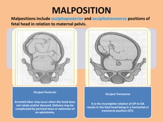 MALPOSITION
Malpositions include occipitoposterior and occipitotransverse positions of
fetal head in relation to maternal pelvis.




               Occiput Posterior
                                                                Occiput Transverse

 Arrested labor may occur when the head does
                                                    It is the incomplete rotation of OP to OA
  not rotate and/or descend. Delivery may be
                                                 results in the fetal head being in a horizontal or
 complicated by perineal tears or extension of
                                                              transverse position (OT).
                an episiotomy.
 