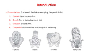 Introduction
• Presentation: Portion of the fetus overlying the pelvic inlet.
1. Cephalic: head presents first.
2. Breech: feet or buttocks present first.
3. Shoulder: presents first.
4. Compound: more than one anatomic part is presenting.
Cephalic Breech Shoulder Compound
 