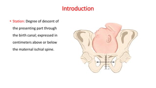 Introduction
• Station: Degree of descent of
the presenting part through
the birth canal; expressed in
centimeters above or below
the maternal ischial spine.
 