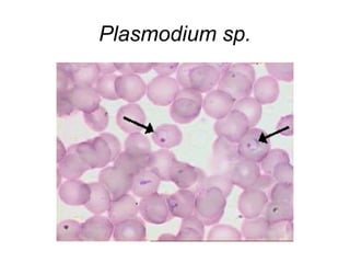 Plasmodium sp.
 