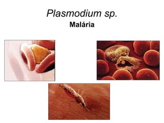 Plasmodium sp.
Malária
 