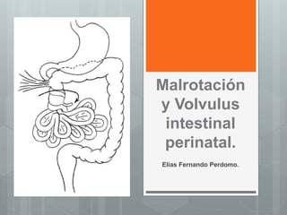 Malrotación
y Volvulus
intestinal
perinatal.
Elías Fernando Perdomo.
 