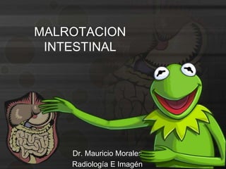 MALROTACION 
INTESTINAL 
Dr. Mauricio Morales 
Radiología E Imagén 
 
