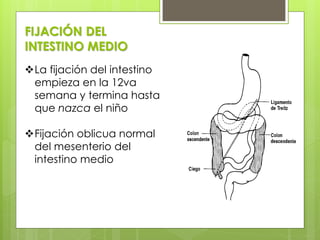 FIJACIÓN DEL INTESTINO MEDIO 
La fijación del intestino empieza en la 12va semana y termina hasta que nazca el niño 
Fijación oblicua normal del mesenterio del intestino medio  