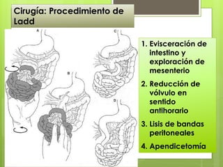 1.Evisceración de intestino y exploración de mesenterio 
2.Reducción de vólvulo en sentido antihorario 
3.Lisis de bandas peritoneales 
4.Apendicetomía 
Cirugía: Procedimiento de Ladd  