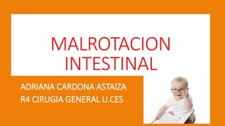 MALROTACION
INTESTINAL
ADRIANA CARDONA ASTAIZA
R4 CIRUGIA GENERAL U.CES
 