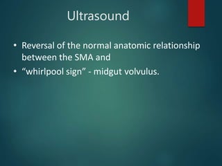 Ultrasound
• Reversal of the normal anatomic relationship
between the SMA and
• “whirlpool sign” - midgut volvulus.
 