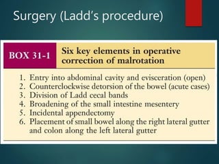 Surgery (Ladd’s procedure)
 