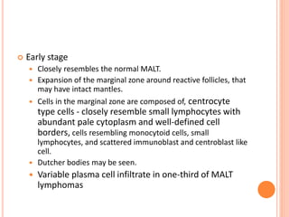  Early stage
 Closely resembles the normal MALT.
 Expansion of the marginal zone around reactive follicles, that
may have intact mantles.
 Cells in the marginal zone are composed of, centrocyte
type cells - closely resemble small lymphocytes with
abundant pale cytoplasm and well-defined cell
borders, cells resembling monocytoid cells, small
lymphocytes, and scattered immunoblast and centroblast like
cell.
 Dutcher bodies may be seen.
 Variable plasma cell infiltrate in one-third of MALT
lymphomas
 