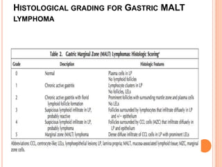 HISTOLOGICAL GRADING FOR GASTRIC MALT
LYMPHOMA
 