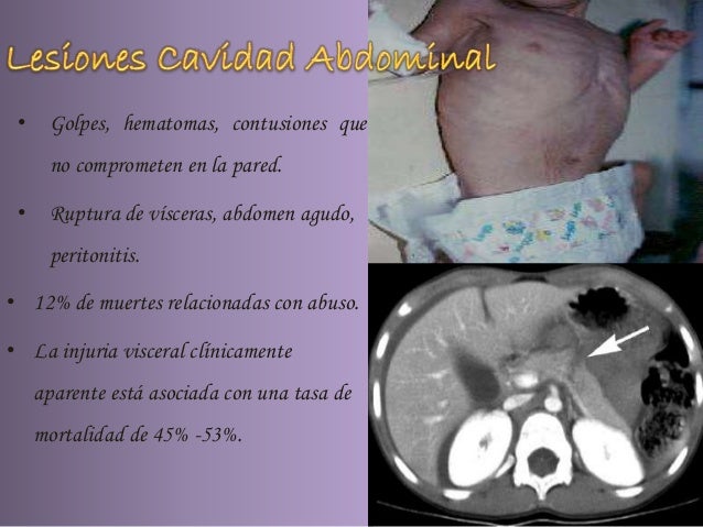 A la hija 4 años caen fuerte los cabellos