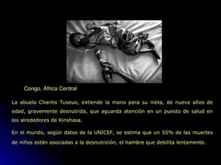 Congo, África Central La abuela Chantis Tuseuo, extiende la mano para su nieta,  de nueve años de edad,   gravemente desnutrida,  que aguarda atención en un puesto de salud en los alrededores de Kinshasa.  En el mundo, según datos de la UNICEF, se estima que un 55% de las muertes de niños están asociadas a la desnutrición, el hambre que debilita lentamente.   