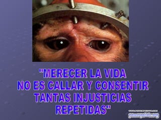 "MERECER LA VIDA NO ES CALLAR Y CONSENTIR TANTAS INJUSTICIAS REPETIDAS" 